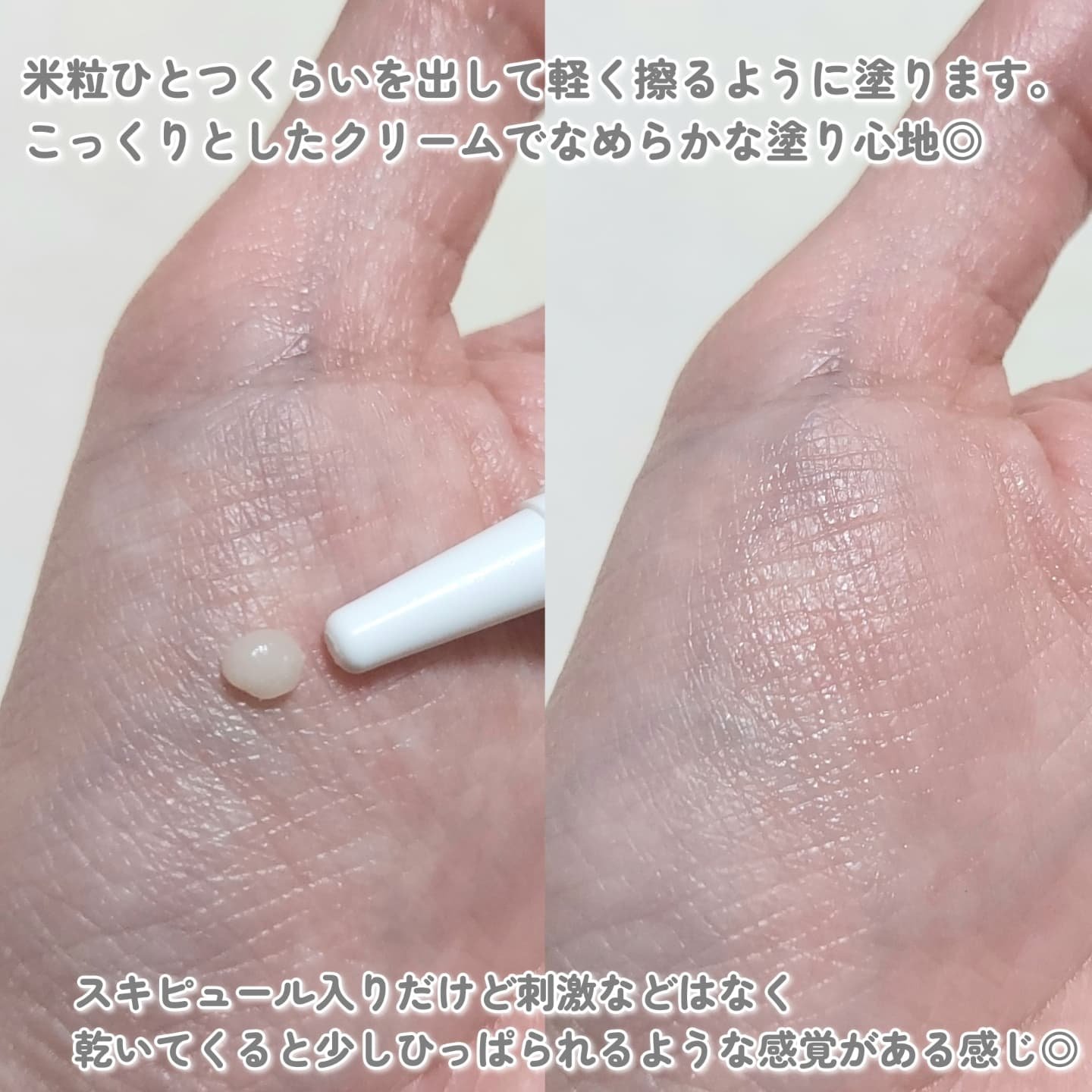 アイファルトアイバッククリーム/Dr.Melaxin/アイケア・アイクリームを使ったクチコミ（3枚目）