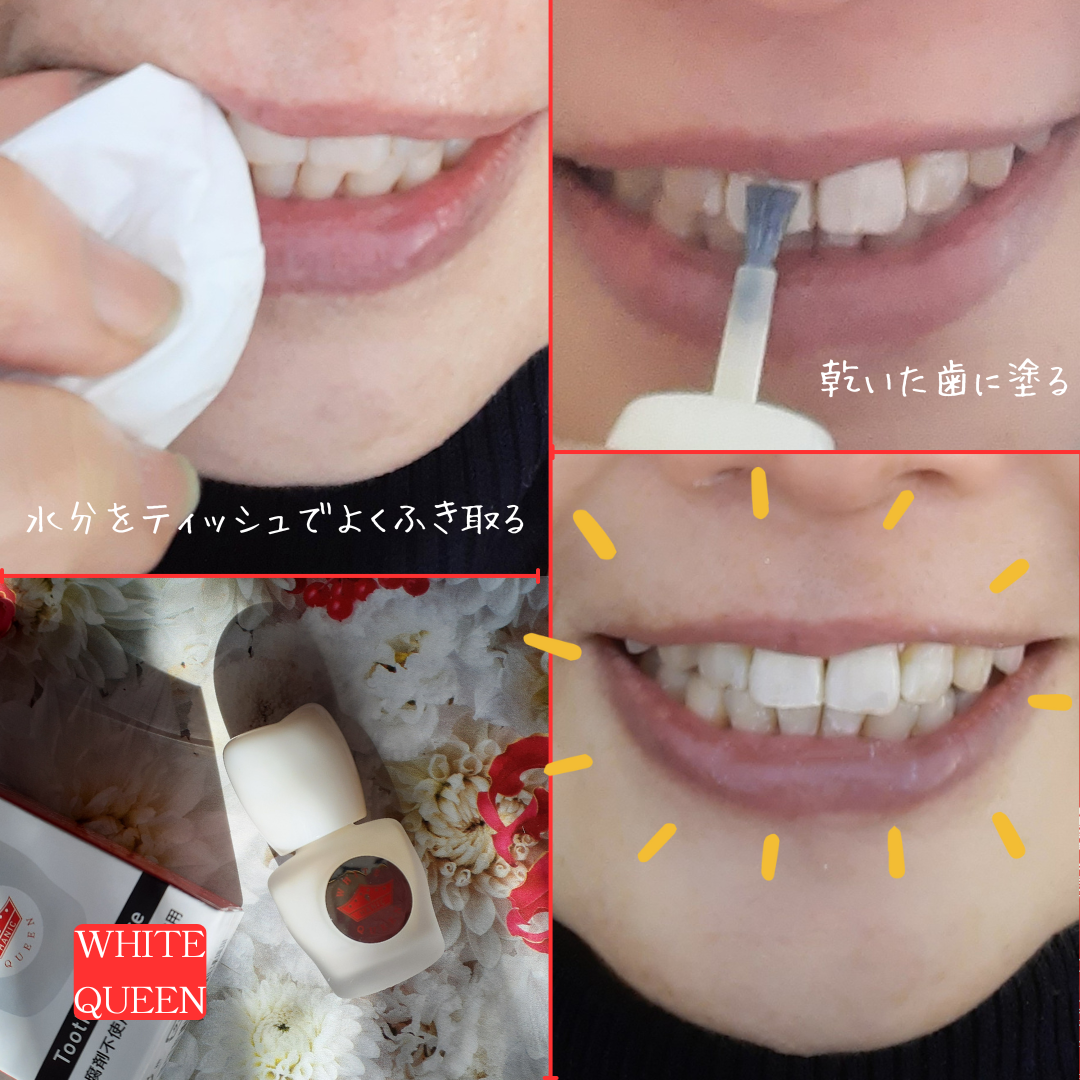 ホワイトクイーン/ハニック・ホワイトラボ/その他オーラルケアを使ったクチコミ(5枚目)