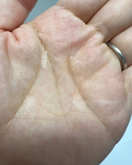 TXナイアシンエッセンストナー/SKIN&LAB/化粧水を使ったクチコミ(3枚目)