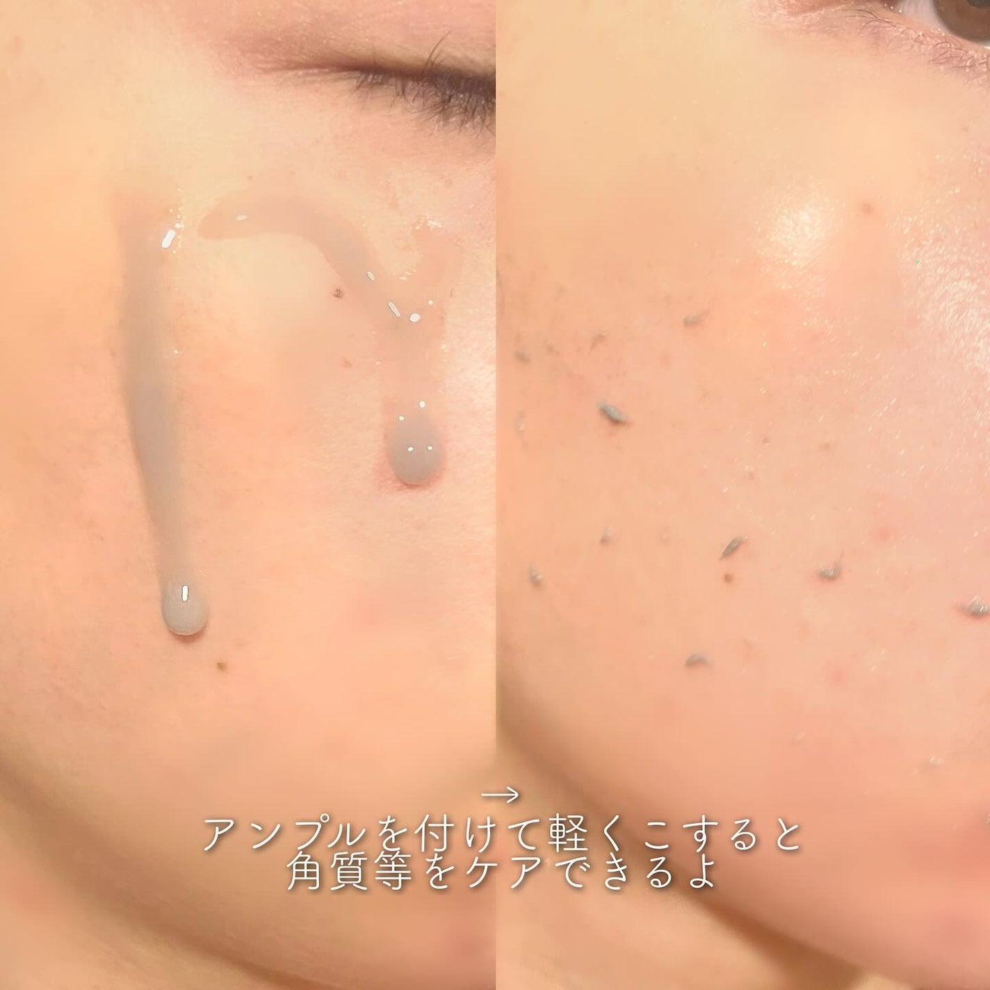 白米ピールショットゴマージュアンプル/Dr.Melaxin/美容液を使ったクチコミ(2枚目)