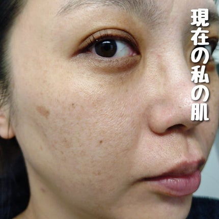 TRUTH DROP/peace of shine/美容液を使ったクチコミ(4枚目)