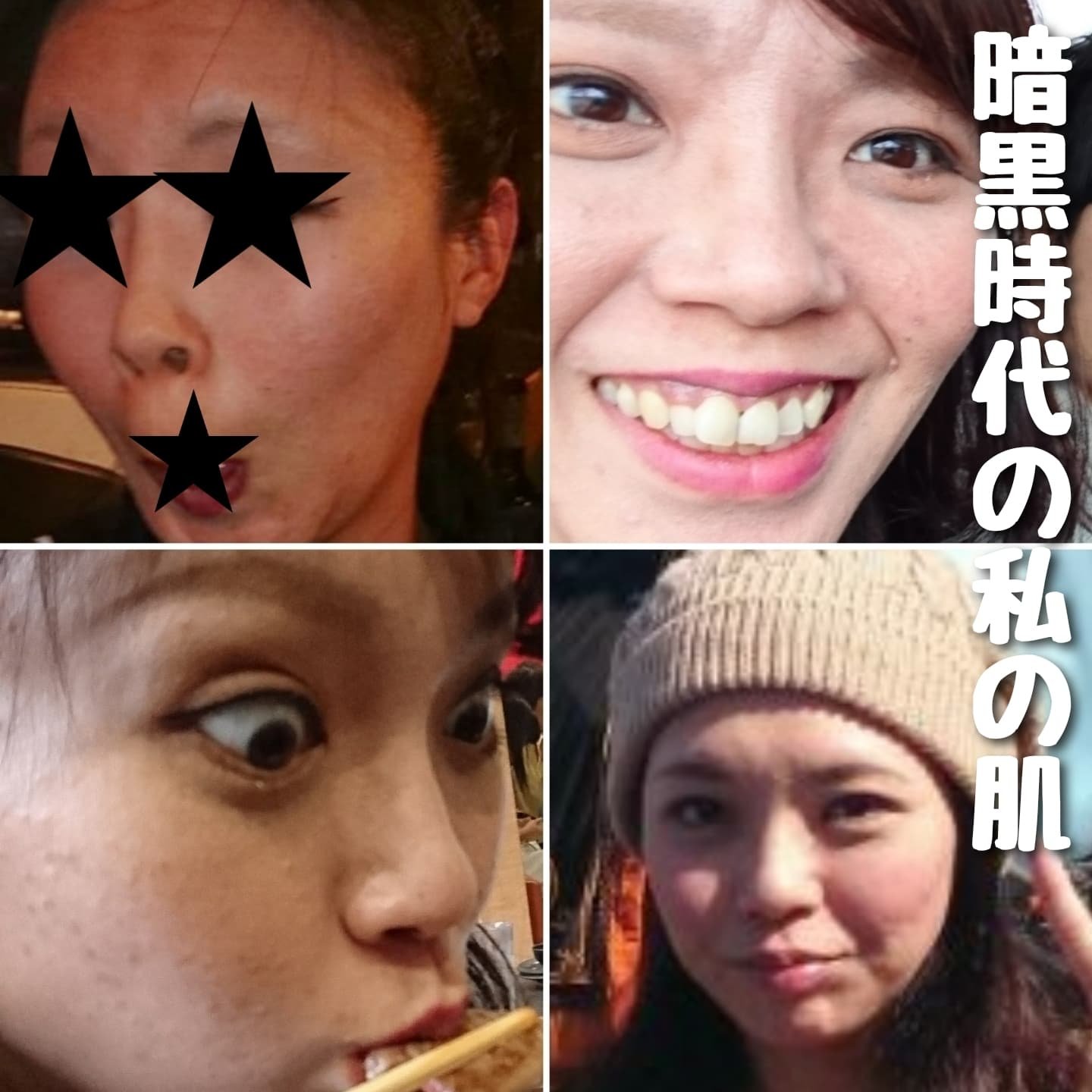 TRUTH DROP/peace of shine/美容液を使ったクチコミ（3枚目）