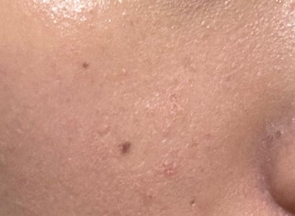 メイク キープ パウダー/コーセーコスメニエンス/ルースパウダーを使ったクチコミ(5枚目)