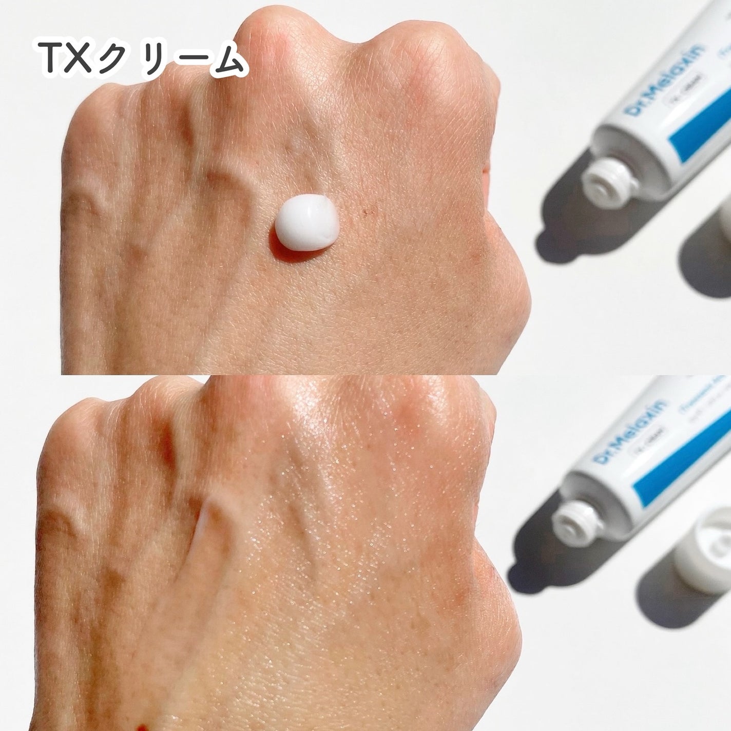 TXアンプルRX+TXクリーム/Dr.Melaxin/スキンケアキットを使ったクチコミ(6枚目)