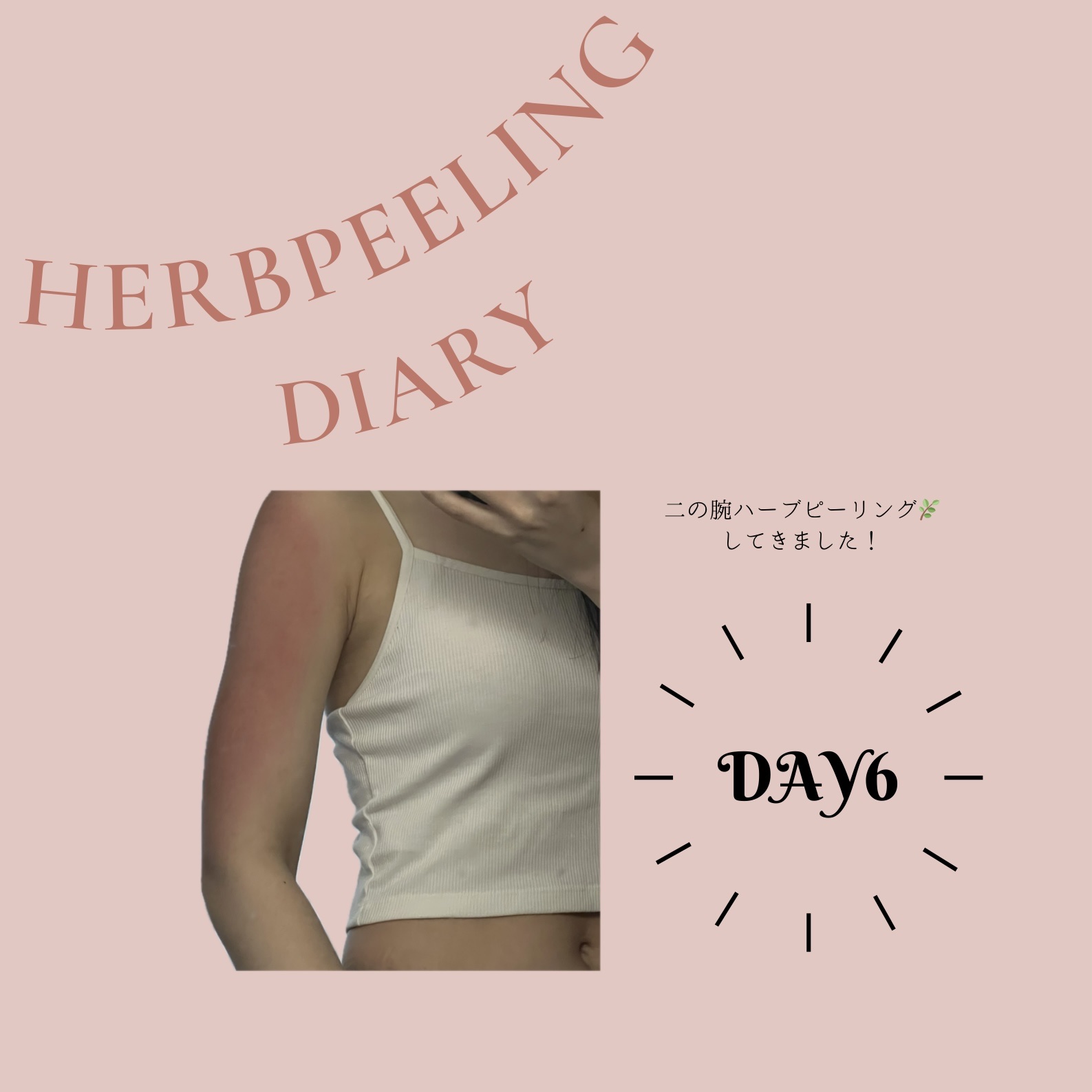 メディカルクリームG（薬用クリームG）/メンターム/ハンドクリームを使ったクチコミ（1枚目）