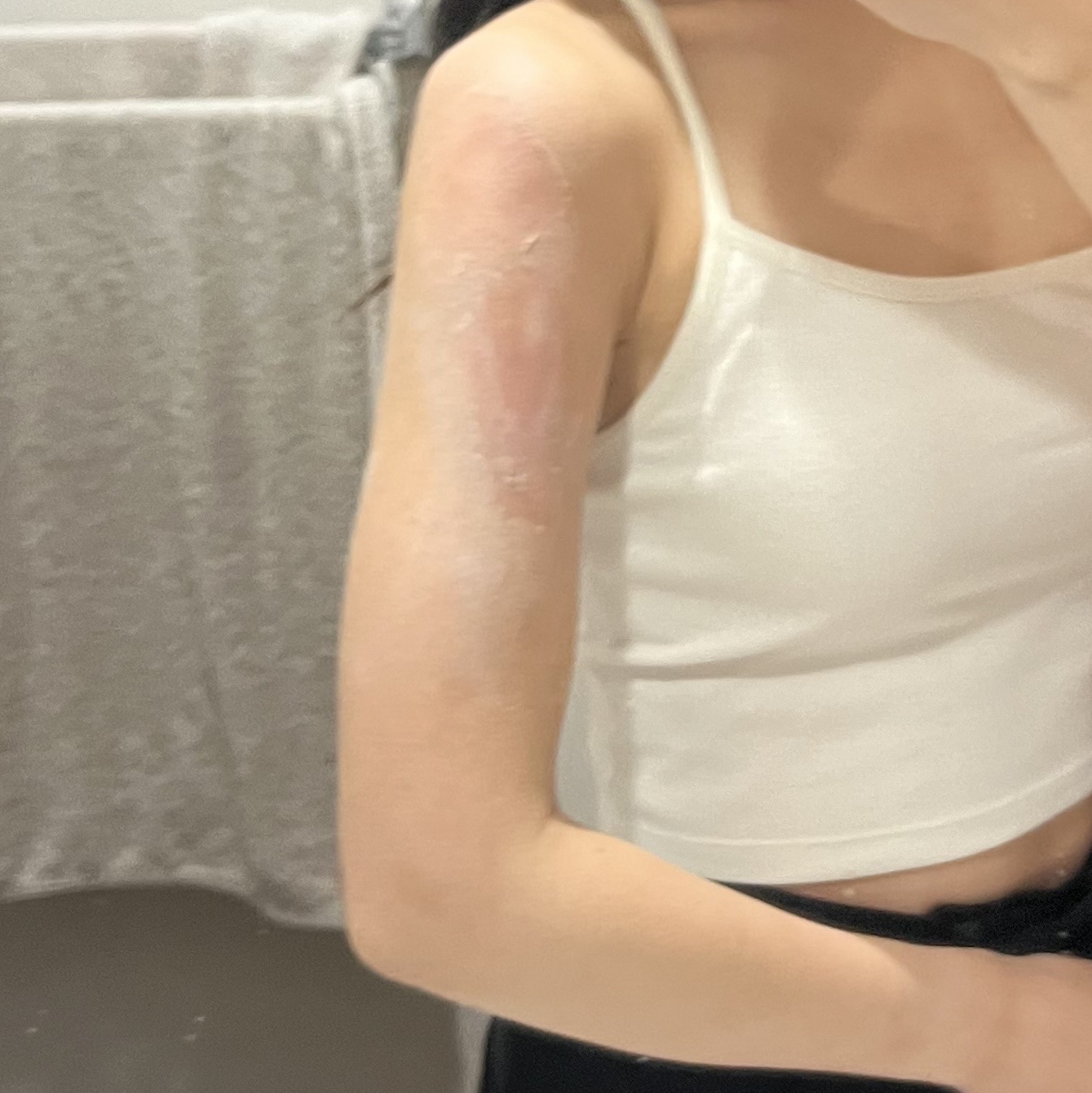 メディカルクリームG（薬用クリームG）/メンターム/ハンドクリームを使ったクチコミ（2枚目）