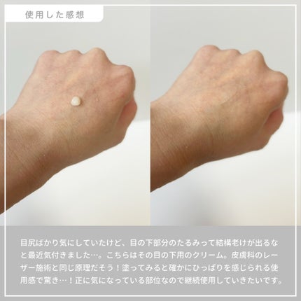 アイファルトアイバッククリーム/Dr.Melaxin/アイケア・アイクリームを使ったクチコミ(3枚目)