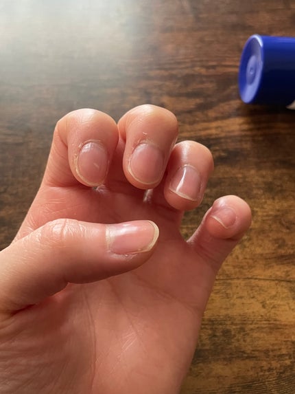 尿素10%クリーム/ハンド・尿素シリーズ/ハンドクリームを使ったクチコミ(2枚目)