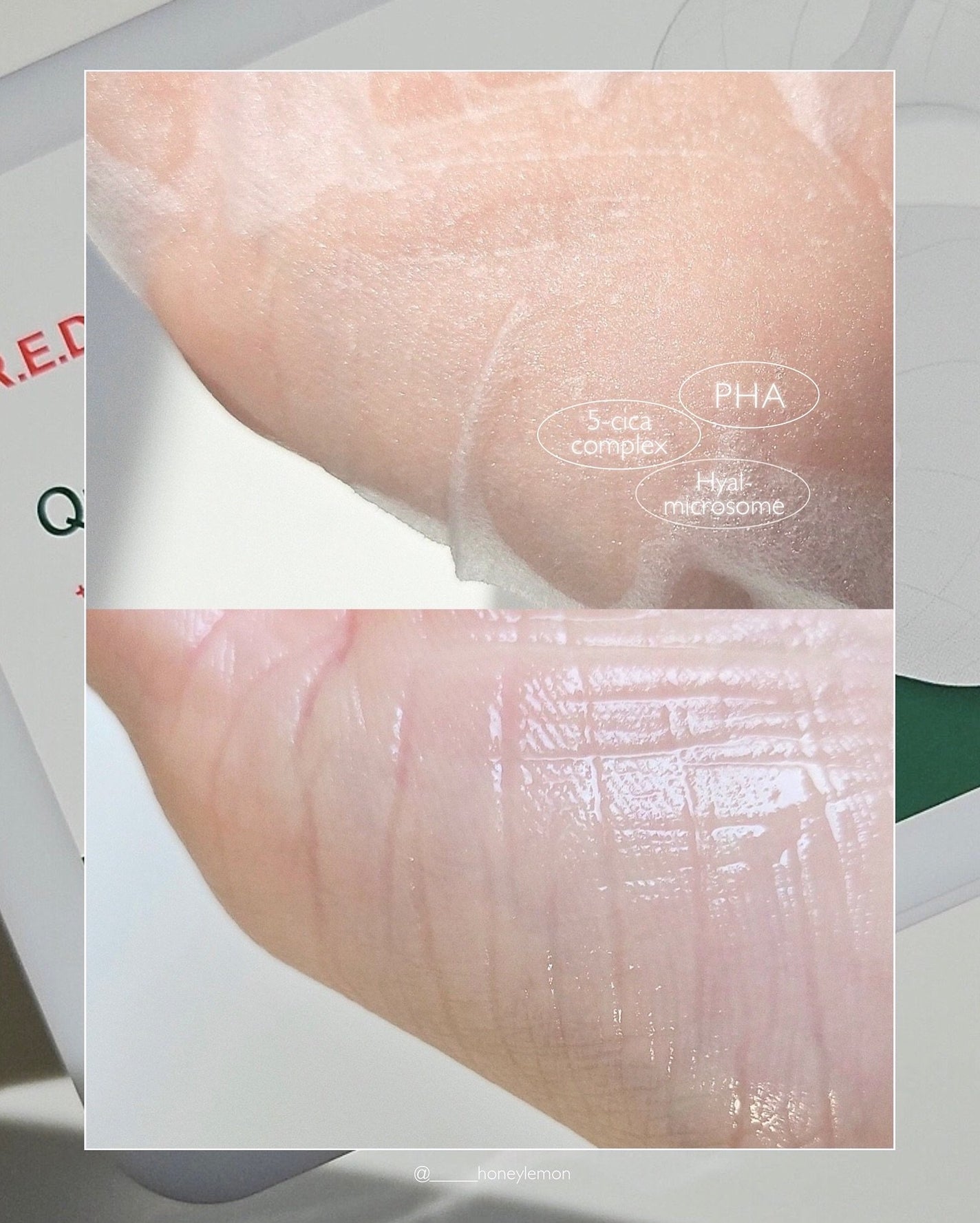 レッドブレミッシュクイックPHAシートマスク/Dr.G/シートマスク・パックを使ったクチコミ(3枚目)