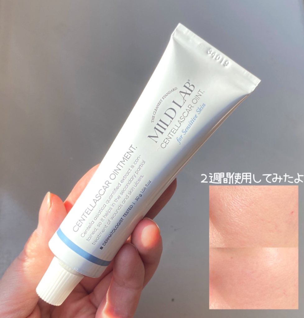 センテラスカー 軟膏 (オイントメント)/Mildlab/フェイスクリームを使ったクチコミ（1枚目）