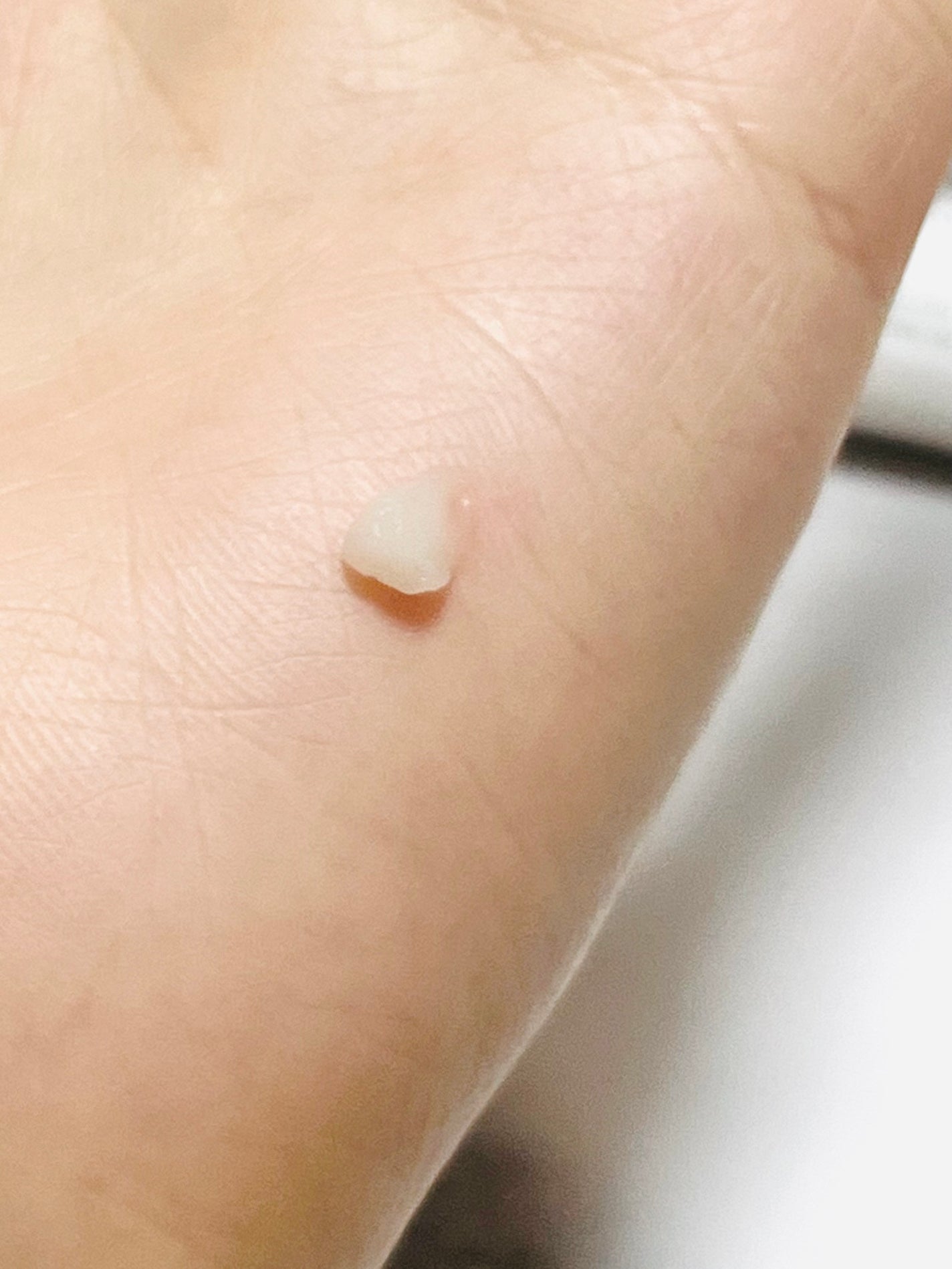 アイファルトアイバッククリーム/Dr.Melaxin/アイケア・アイクリームを使ったクチコミ(3枚目)