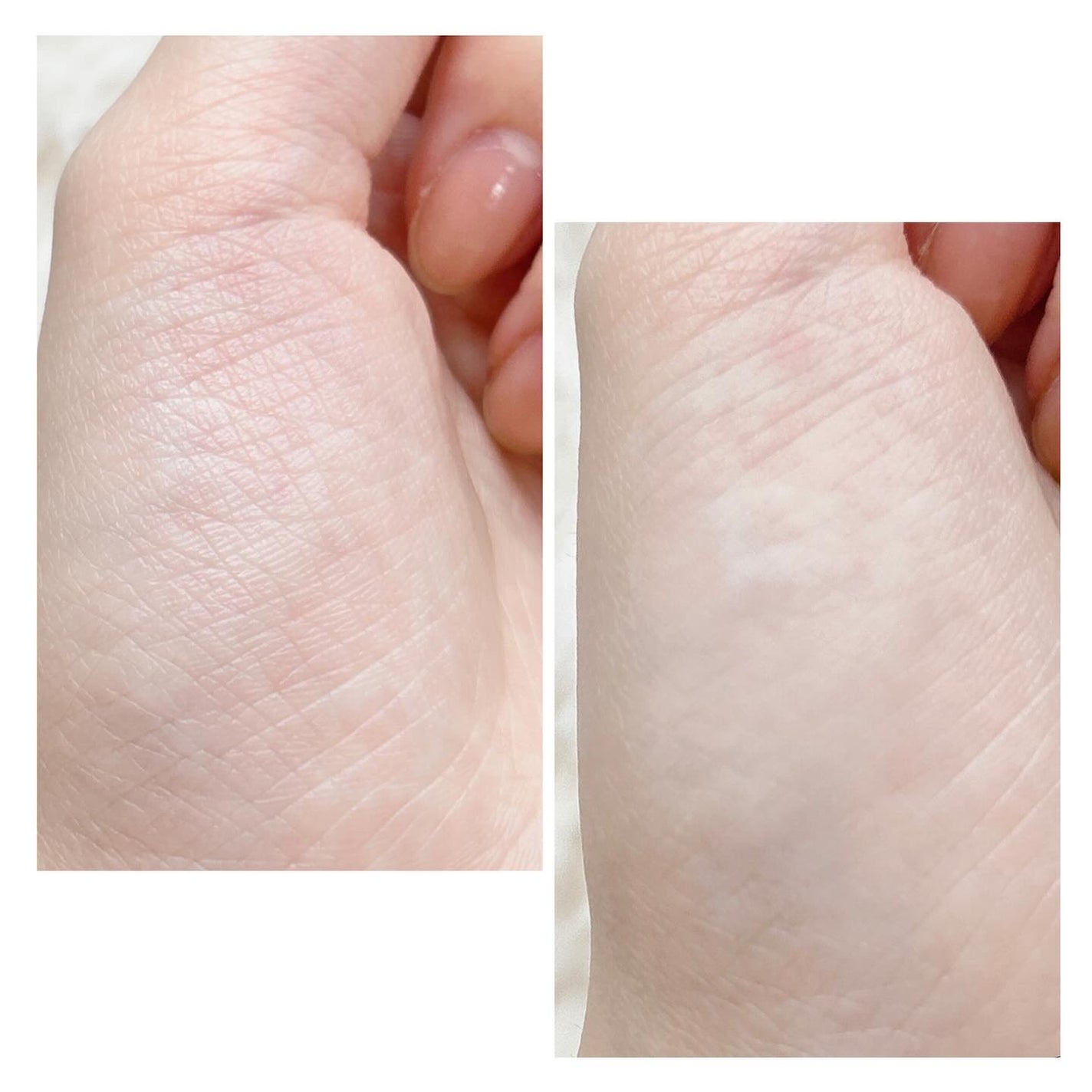 アイファルトアイバッククリーム/Dr.Melaxin/アイケア・アイクリームを使ったクチコミ(5枚目)