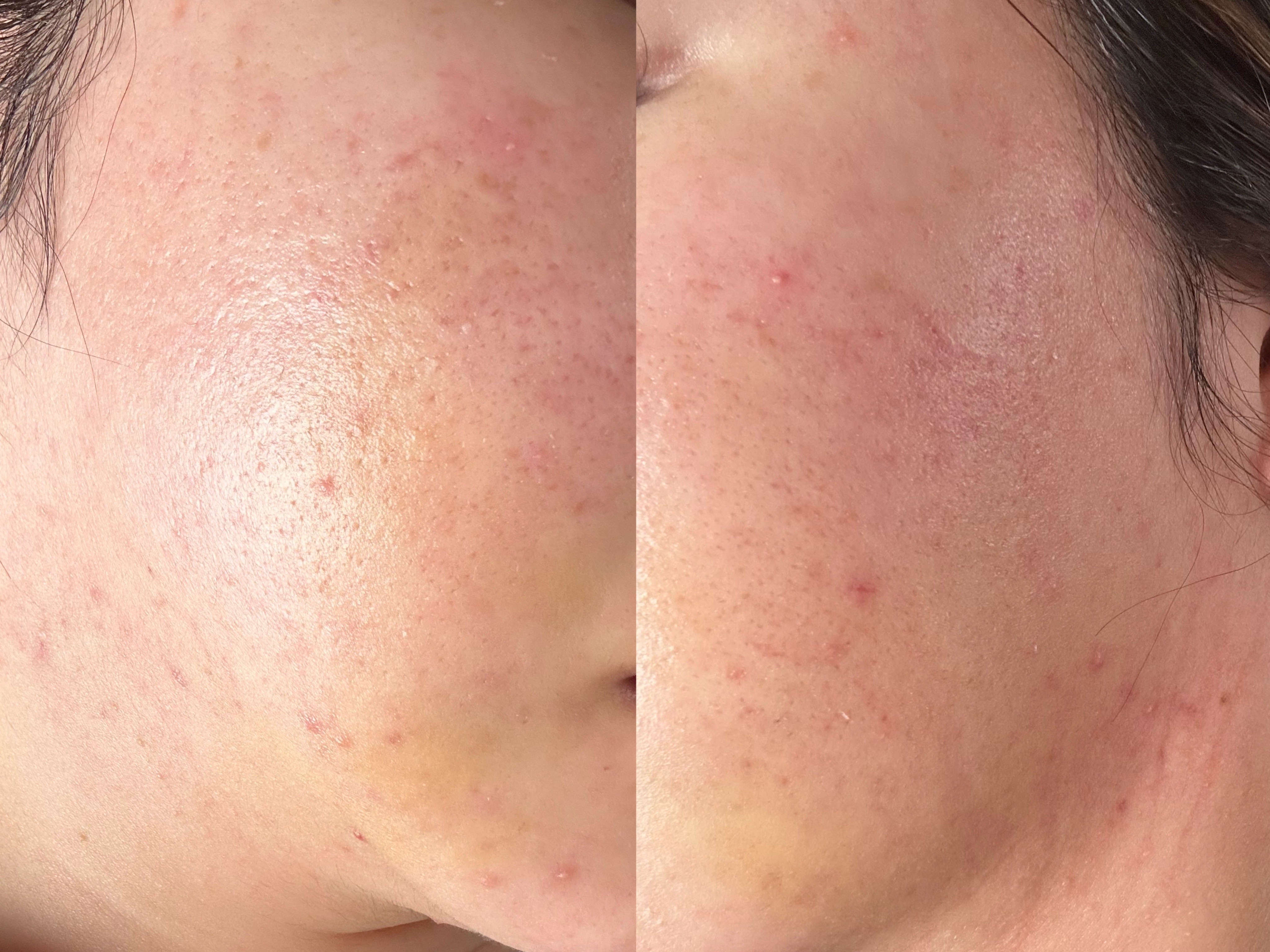 ATO CREAM MD /REJUDERMA/フェイスクリームを使ったクチコミ（1枚目）