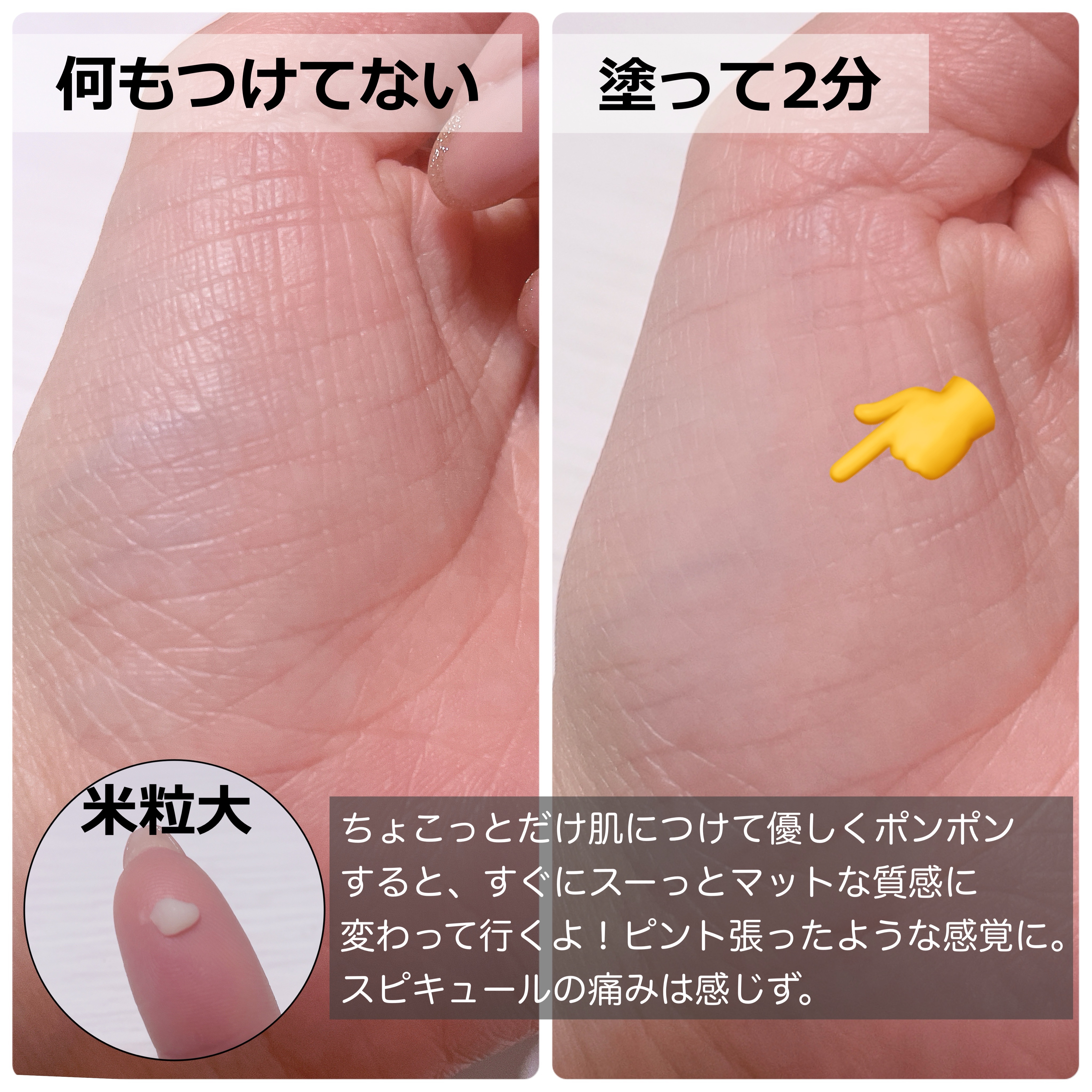 アイファルトアイバッククリーム/Dr.Melaxin/アイケア・アイクリームを使ったクチコミ（3枚目）