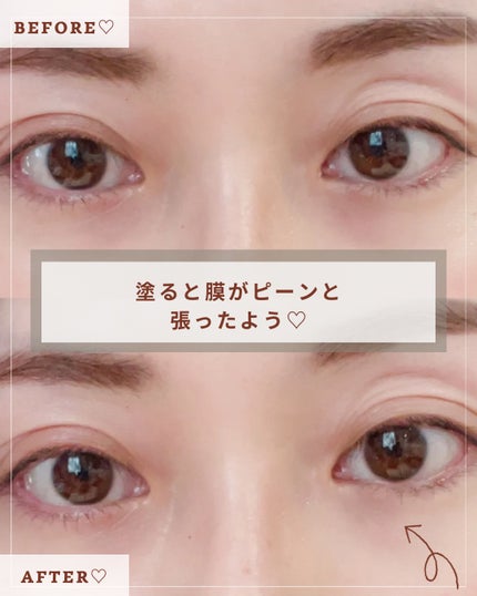 アイファルトアイバッククリーム/Dr.Melaxin/アイケア・アイクリームを使ったクチコミ(4枚目)