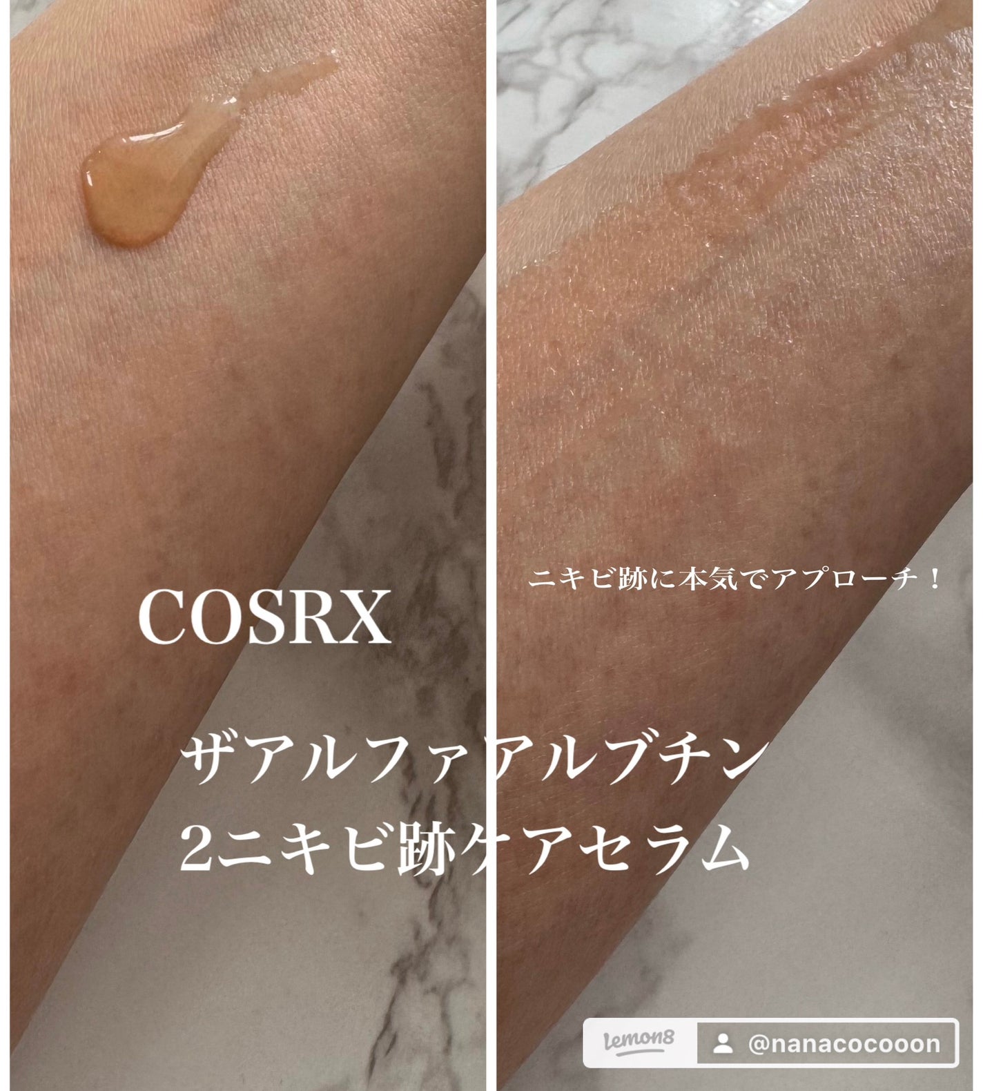 RXザ・アルファアルブチン2 ニキビ跡ケアセラム/COSRX/美容液を使ったクチコミ(4枚目)