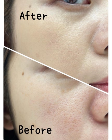 ヴェールヌーディ エッセンスパクトグロウ/AGE20’s/クリーム・エマルジョンファンデーションを使ったクチコミ(4枚目)