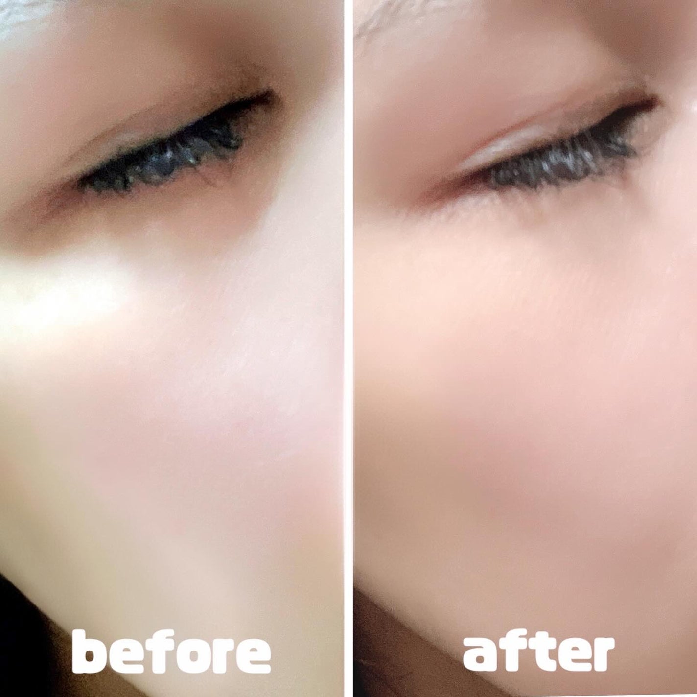 アイファルトアイバッククリーム/Dr.Melaxin/アイケア・アイクリームを使ったクチコミ(4枚目)