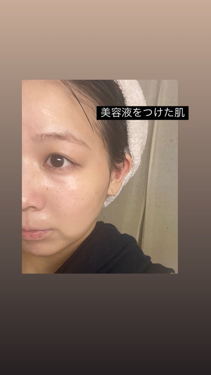 PDRNヒアルロン酸カプセル100セラム/Anua/美容液を使ったクチコミ(3枚目)