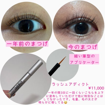 ラッシュアディクト アイラッシュコンディショニングセラム/soaddicted/まつげ美容液を使ったクチコミ(2枚目)