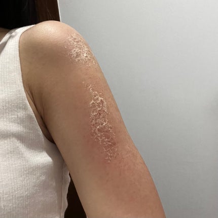 メディカルクリームG(薬用クリームG)/メンターム/ハンドクリームを使ったクチコミ(4枚目)