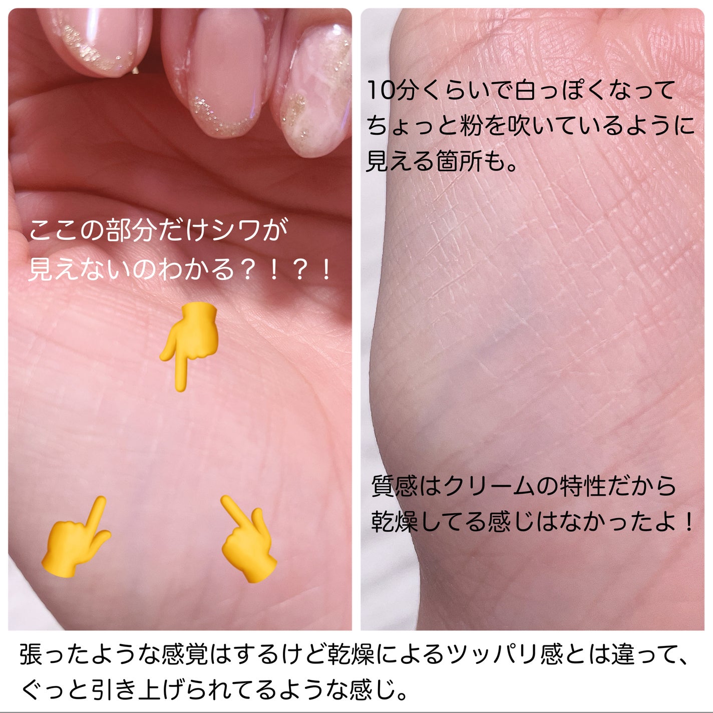 アイファルトアイバッククリーム/Dr.Melaxin/アイケア・アイクリームを使ったクチコミ(4枚目)