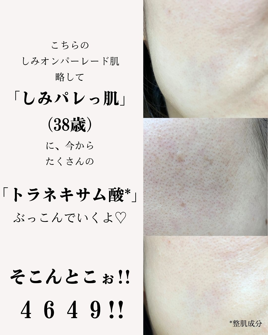 TX-Cream/Dr.Melaxin/フェイスクリームを使ったクチコミ（3枚目）