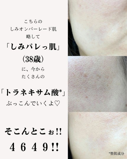 TX-Cream/Dr.Melaxin/フェイスクリームを使ったクチコミ(3枚目)