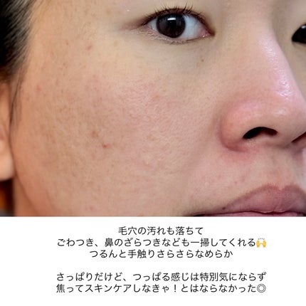 トリートメント エンザイム クレンジング フォーム/アモーレパシフィック/洗顔フォームを使ったクチコミ(4枚目)