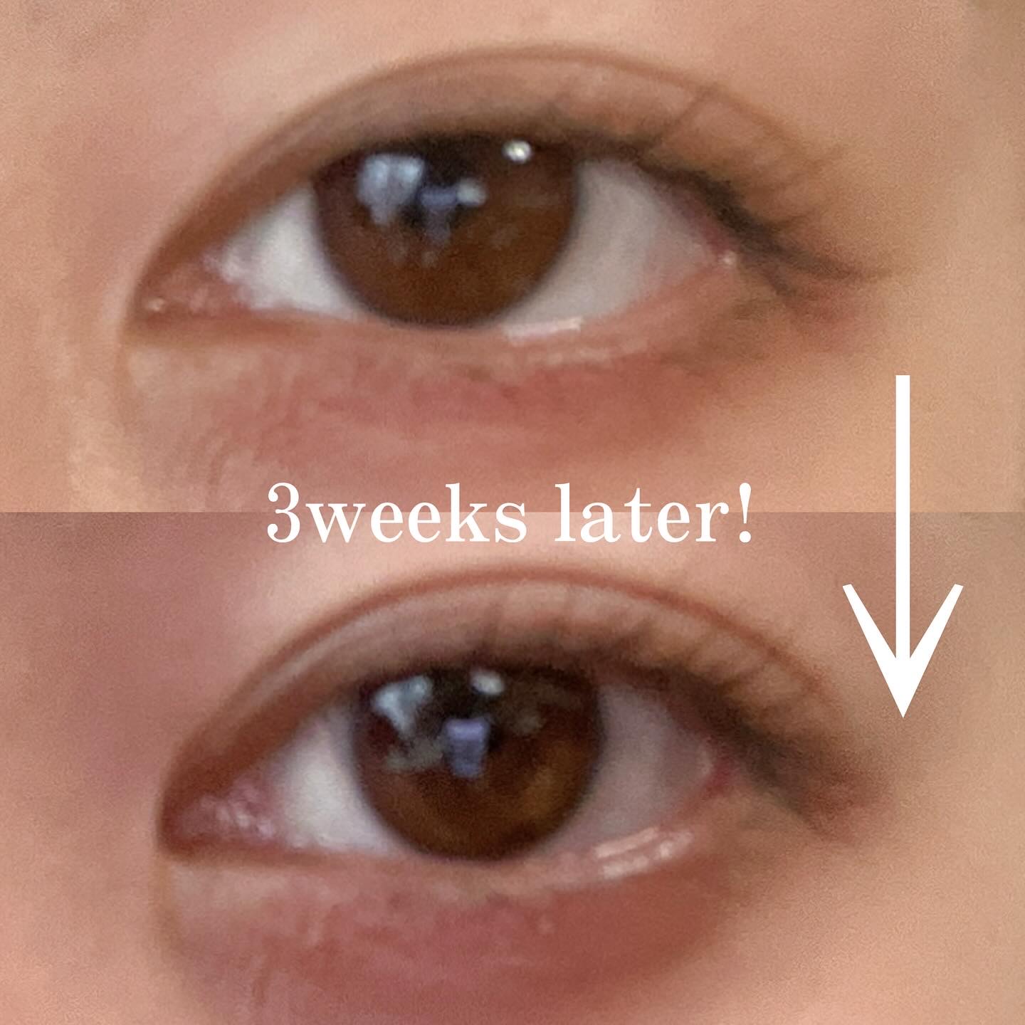 LASH GRACE/MK cosmetics/まつげ美容液を使ったクチコミ（2枚目）