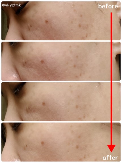 フレッシュリージュースドビタミンドロップ(35ml)/Klairs/美容液を使ったクチコミ(3枚目)