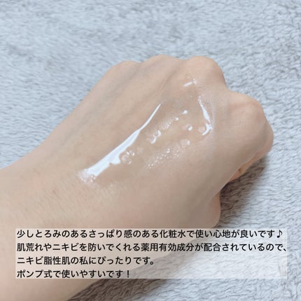 モイストケア ローション MB/d プログラム/化粧水を使ったクチコミ(3枚目)