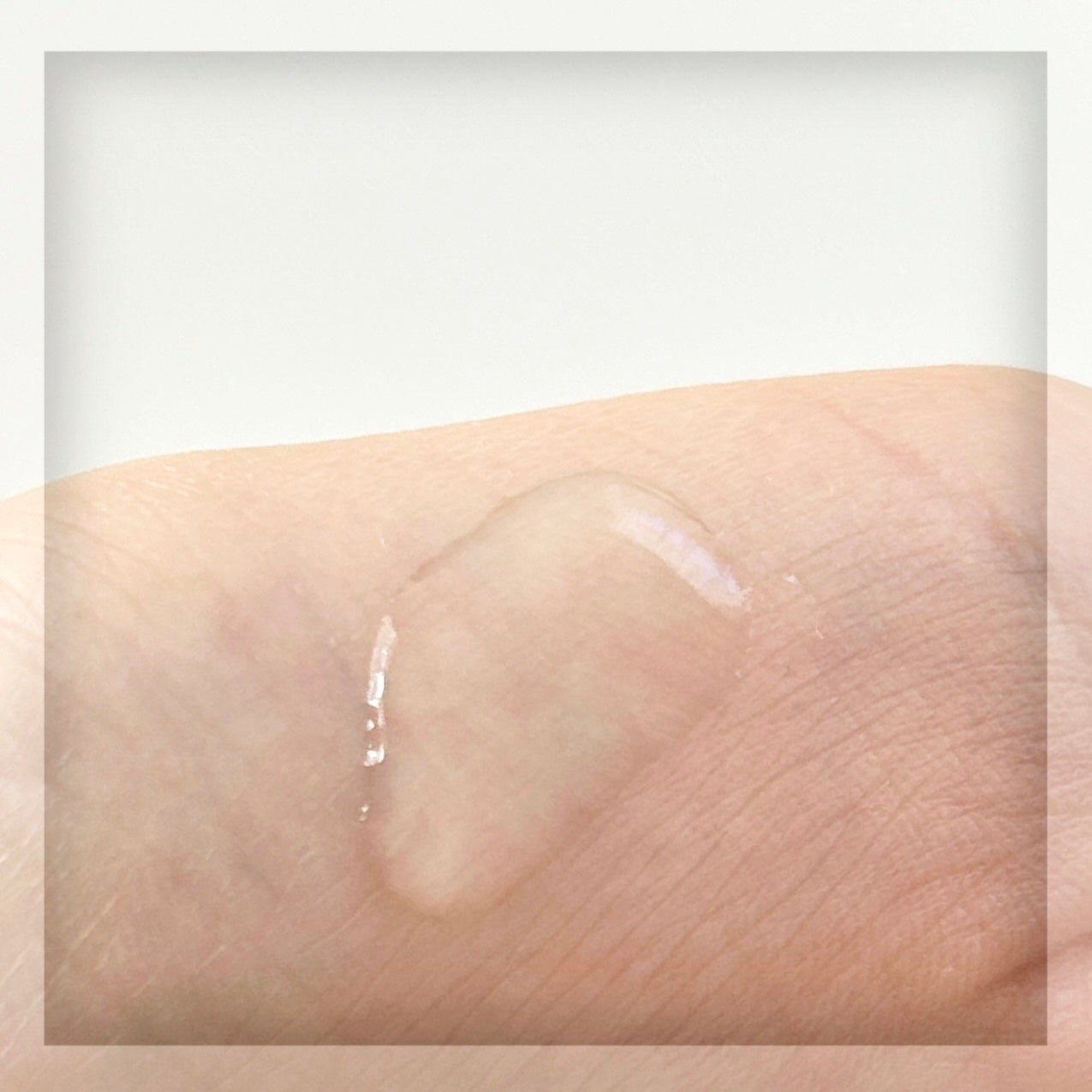 ダーマアンサーアゼライン酸ミントアンプル/CNP Laboratory/美容液を使ったクチコミ(4枚目)