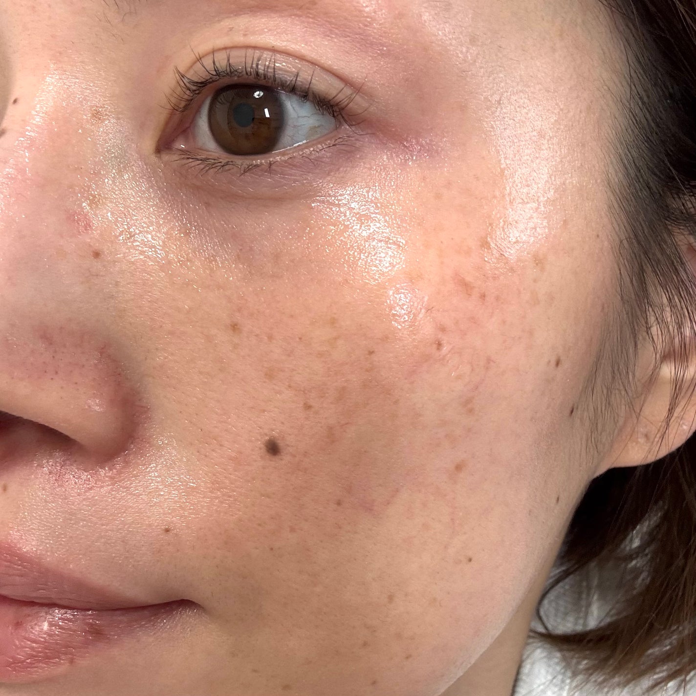 エテルナム セラム/エテルナム/美容液を使ったクチコミ(6枚目)