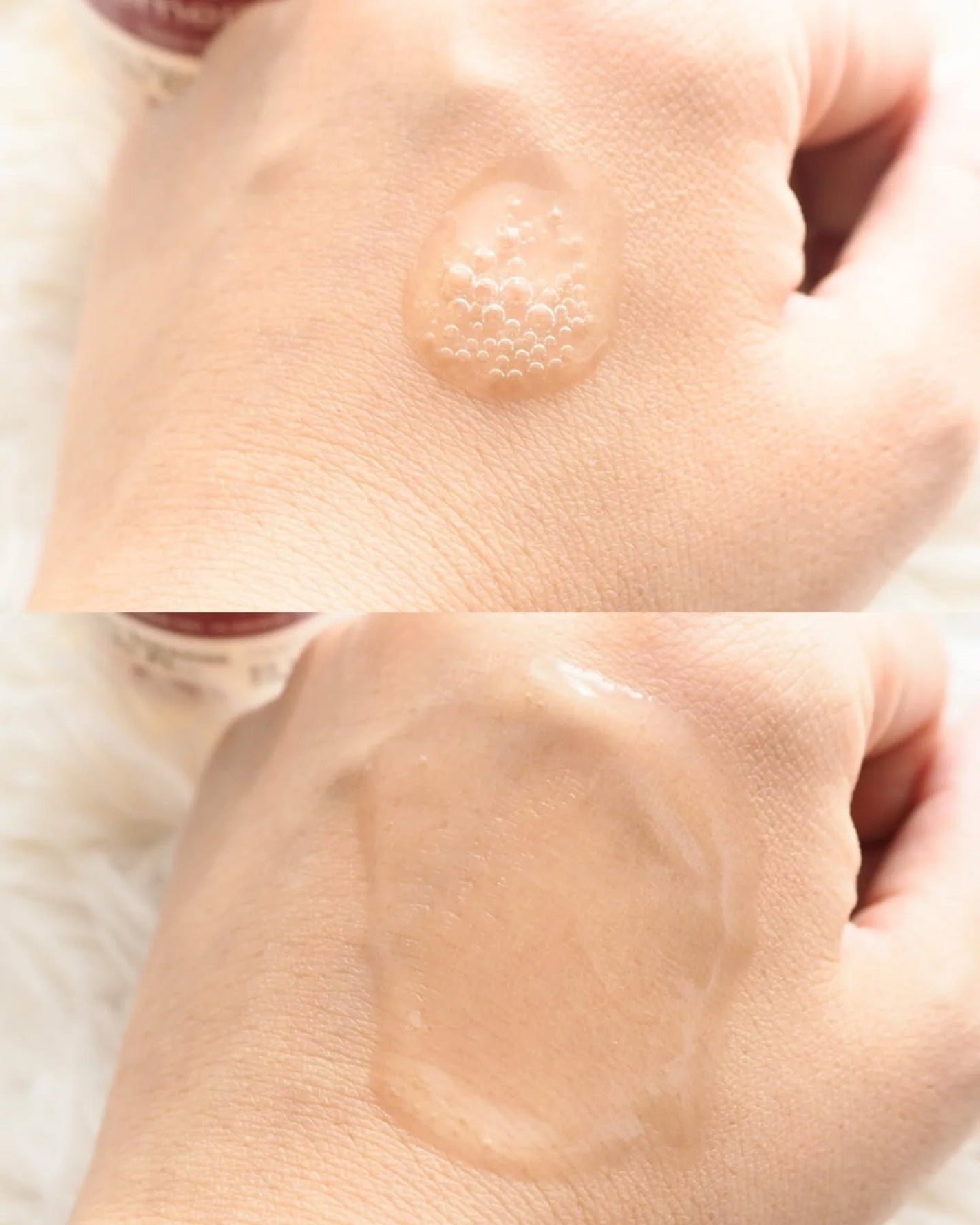 セメンリトカルシウムアンプル+セメンリトカルシウムクリーム/Dr.Melaxin/スキンケアキットを使ったクチコミ(3枚目)