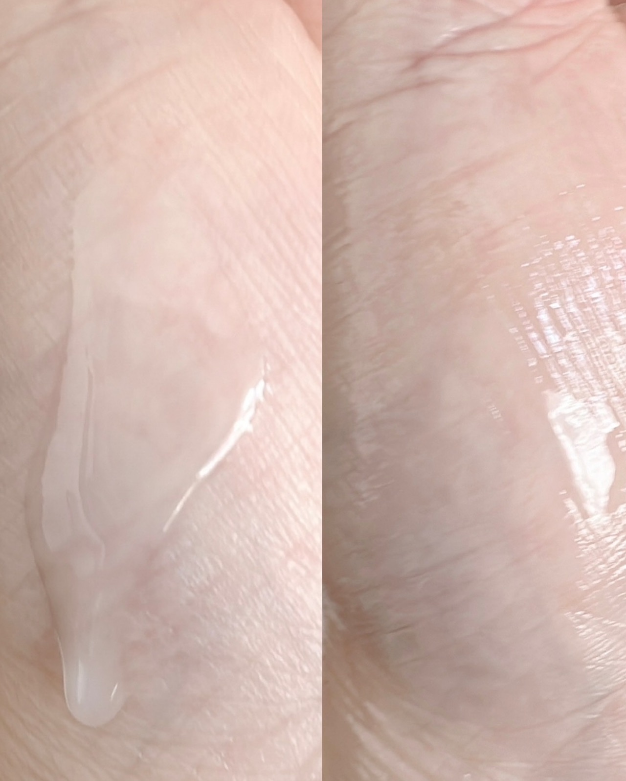 TX-Cream/Dr.Melaxin/フェイスクリームを使ったクチコミ（3枚目）