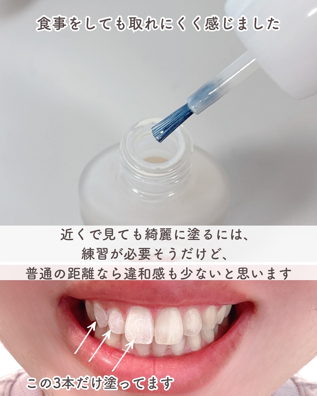 ホワイトクイーン/ハニック・ホワイトラボ/その他オーラルケアを使ったクチコミ（3枚目）