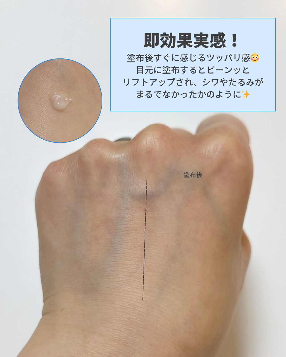 アイファルトアイバッククリーム/Dr.Melaxin/アイケア・アイクリームを使ったクチコミ（3枚目）