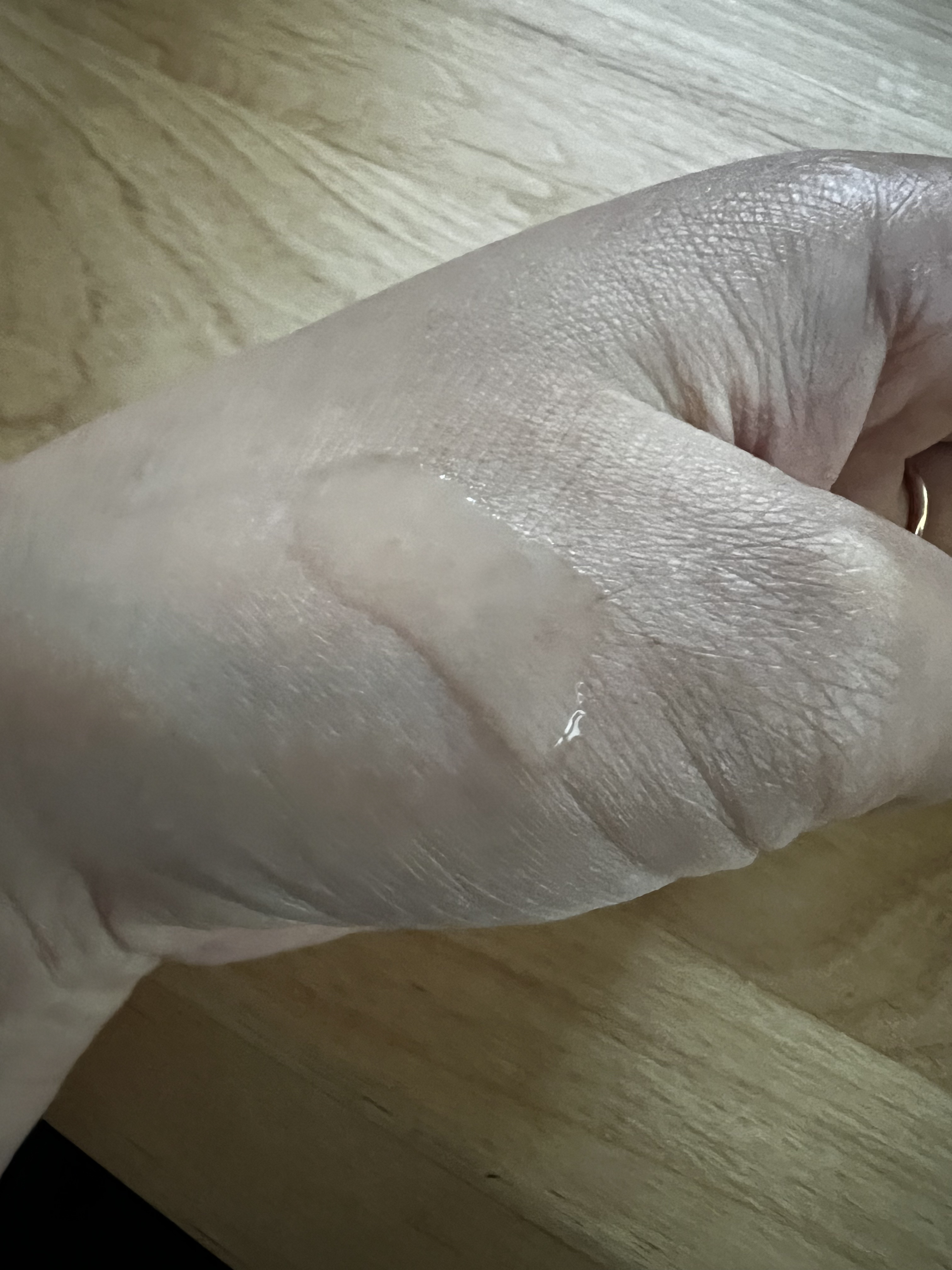 センテラ アンプル/SKIN1004/美容液を使ったクチコミ（2枚目）