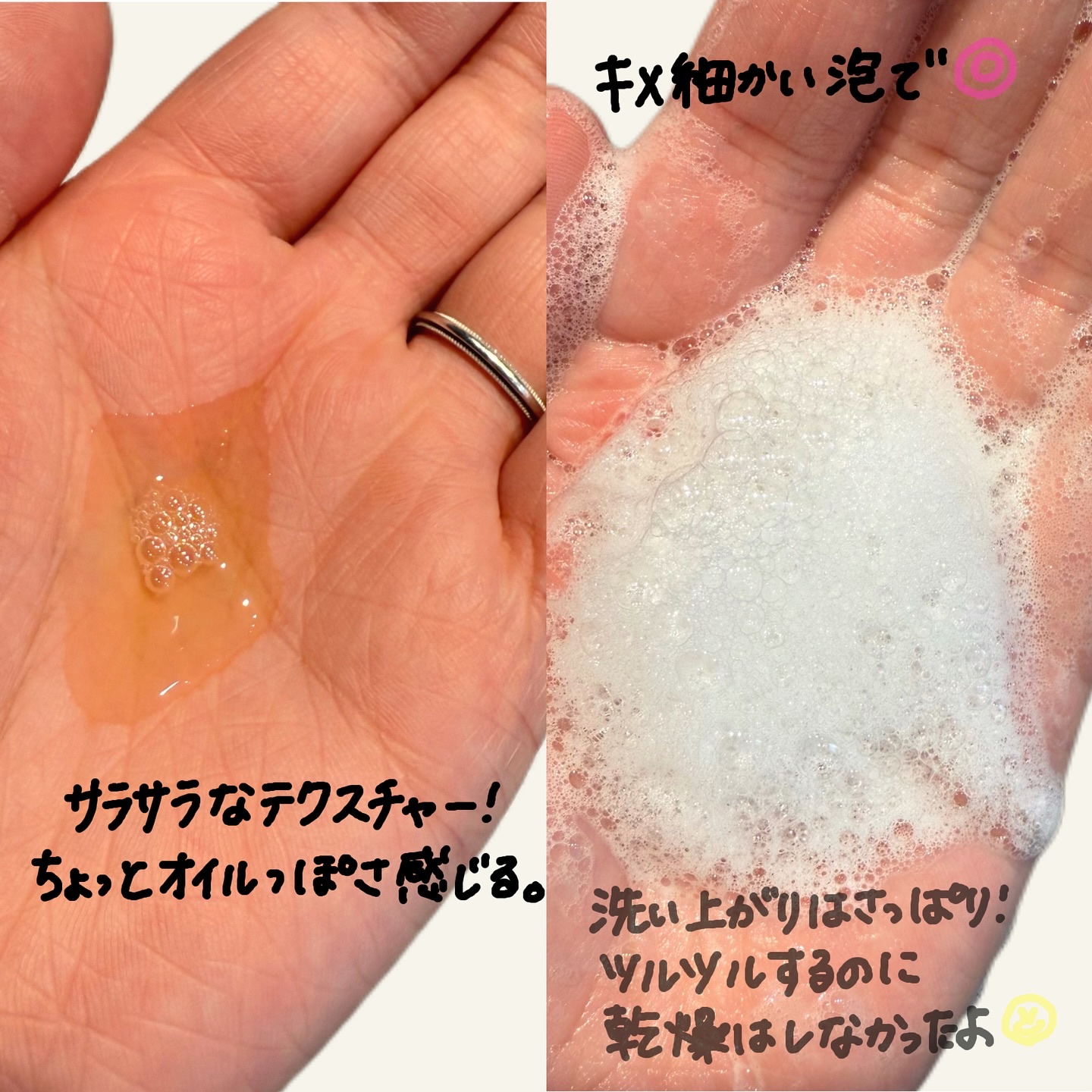 TXアンプルRX＋TXクリーム/Dr.Melaxin/スキンケアキットを使ったクチコミ（3枚目）