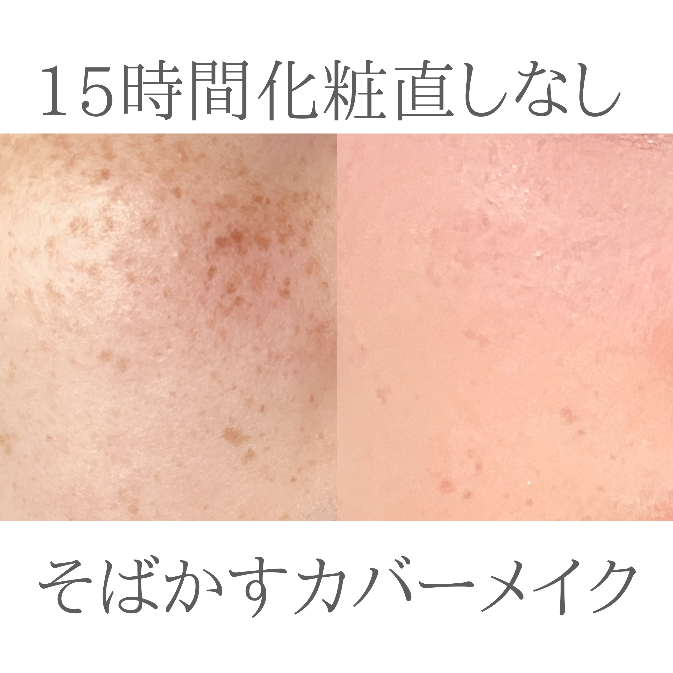 閲覧ありがとうございます(⋆ᴗ͈ˬᴗ͈)”

••┈┈┈┈┈┈┈┈┈┈┈┈┈┈┈┈••

私が個人的に自分用メモのように更新してる
そばかすカバーメイクのやり方です

⚠️注意⚠️
肌質は人それぞれなので合う合わないがあるので合わないなと思