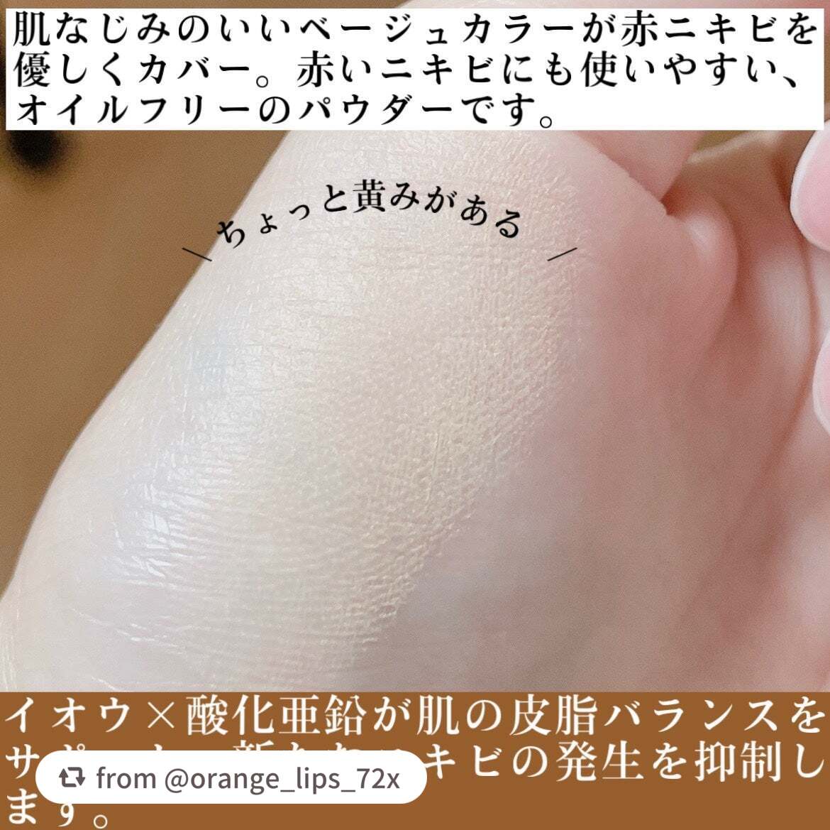 薬用コンシーラー アクネプロテクター/ONLY MINERALS/パウダーコンシーラーを使ったクチコミ(3枚目)