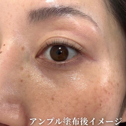 Cemenrete Calcium Intense Cream/Dr.Melaxin/フェイスクリームを使ったクチコミ(5枚目)