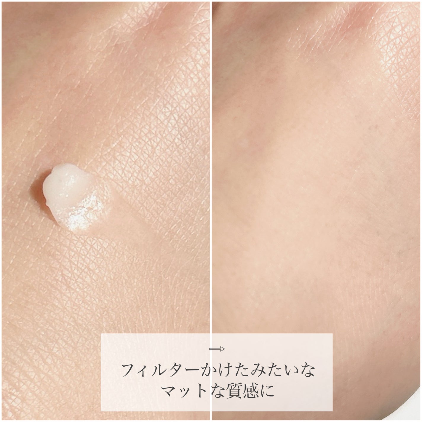 アイファルトアイバッククリーム/Dr.Melaxin/アイケア・アイクリームを使ったクチコミ(3枚目)