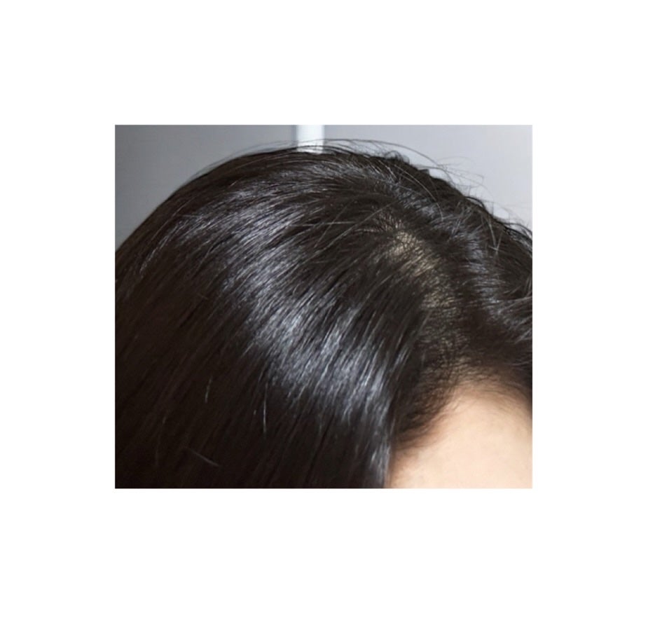 アロマ リヴァイタ アドバンスト スキャルプトリートメント/ラ・カスタ/頭皮ケアを使ったクチコミ(3枚目)