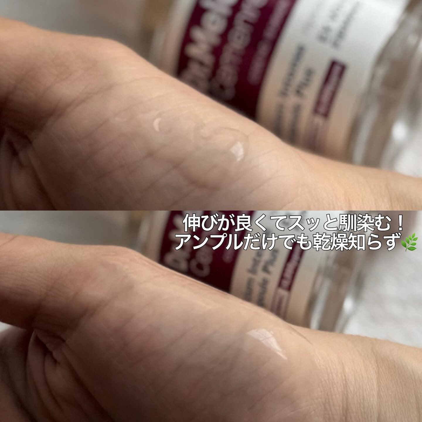 セメンリトカルシウムアンプル+セメンリトカルシウムクリーム/Dr.Melaxin/スキンケアキットを使ったクチコミ（3枚目）