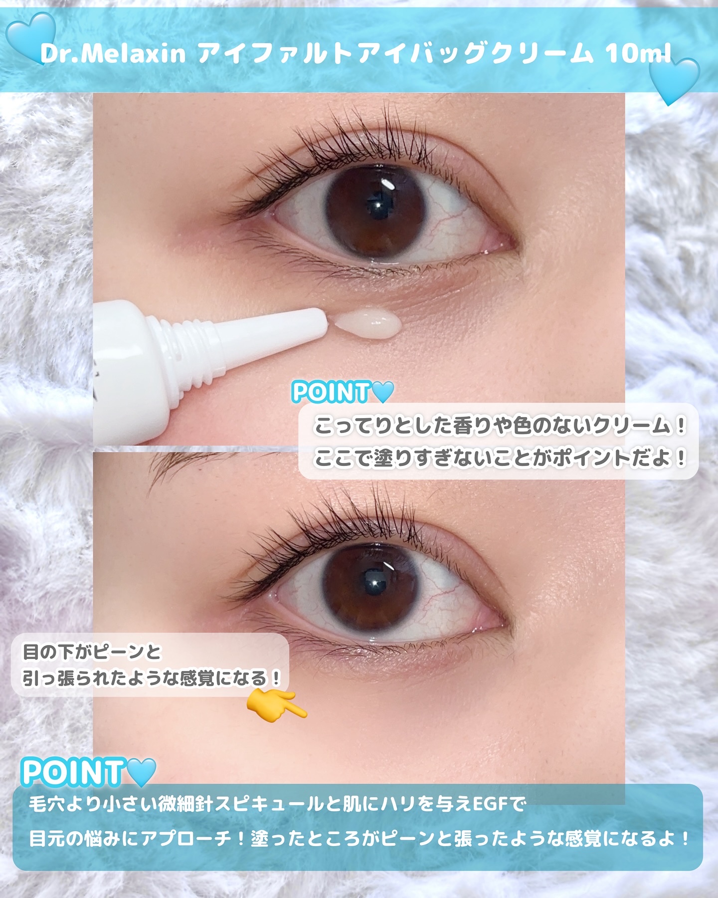 アイファルトアイバッククリーム/Dr.Melaxin/アイケア・アイクリームを使ったクチコミ（3枚目）