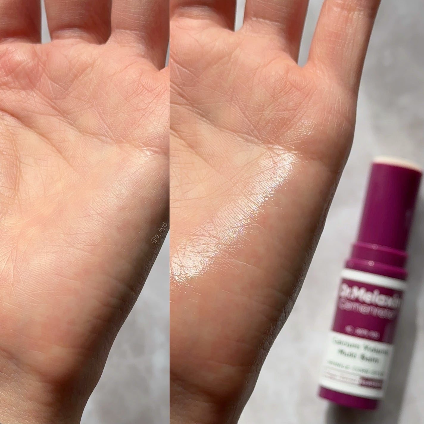 Cemenrete Calcium Intense Cream/Dr.Melaxin/フェイスクリームを使ったクチコミ(9枚目)