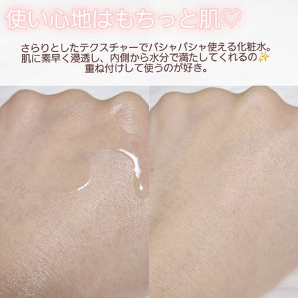 TXナイアシンエッセンストナー/SKIN&LAB/化粧水を使ったクチコミ(5枚目)