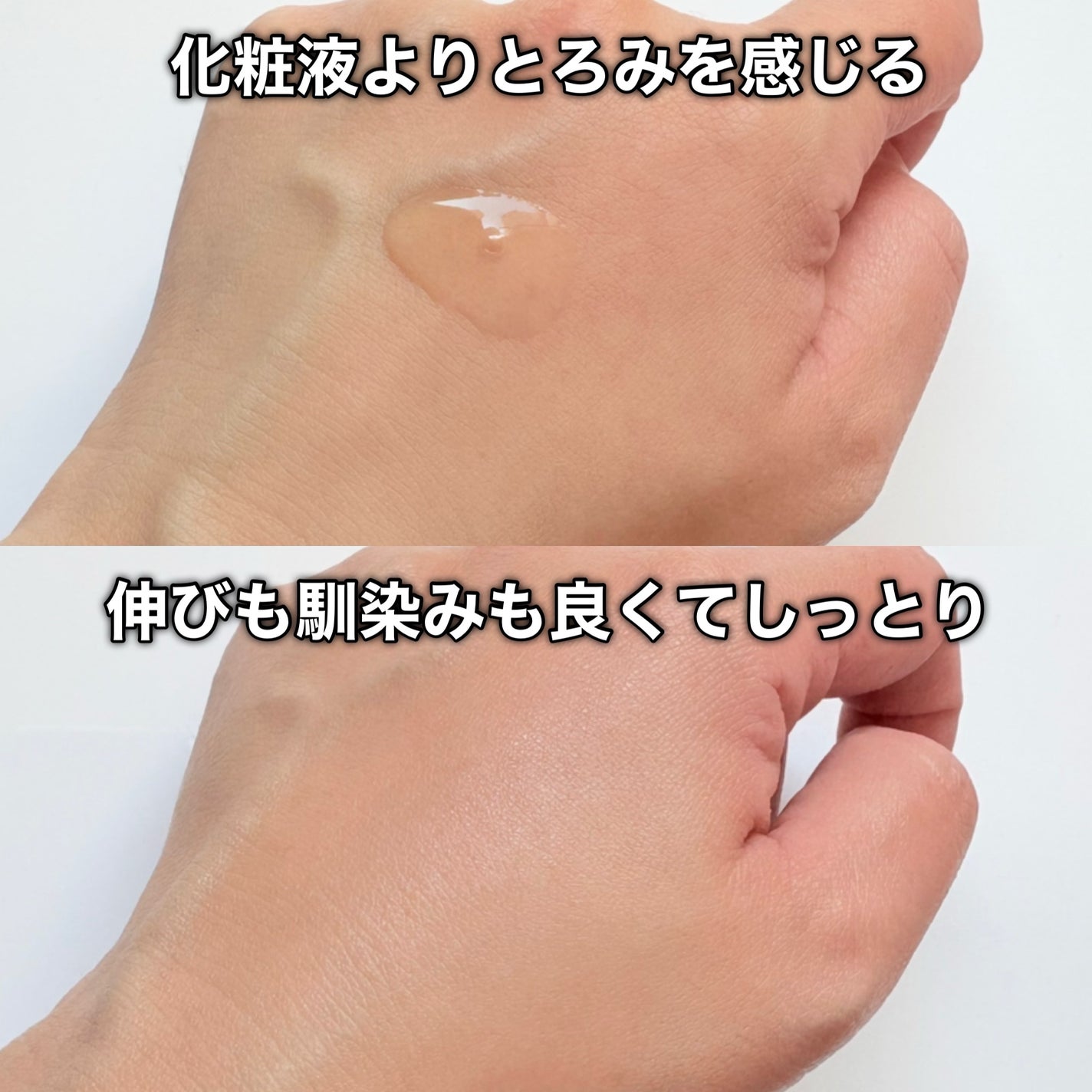 サナ リンクルターン アドバンスト 薬用リペア グロウハイドレーター【医薬部外品】/サナ リンクルターン/化粧水を使ったクチコミ(6枚目)